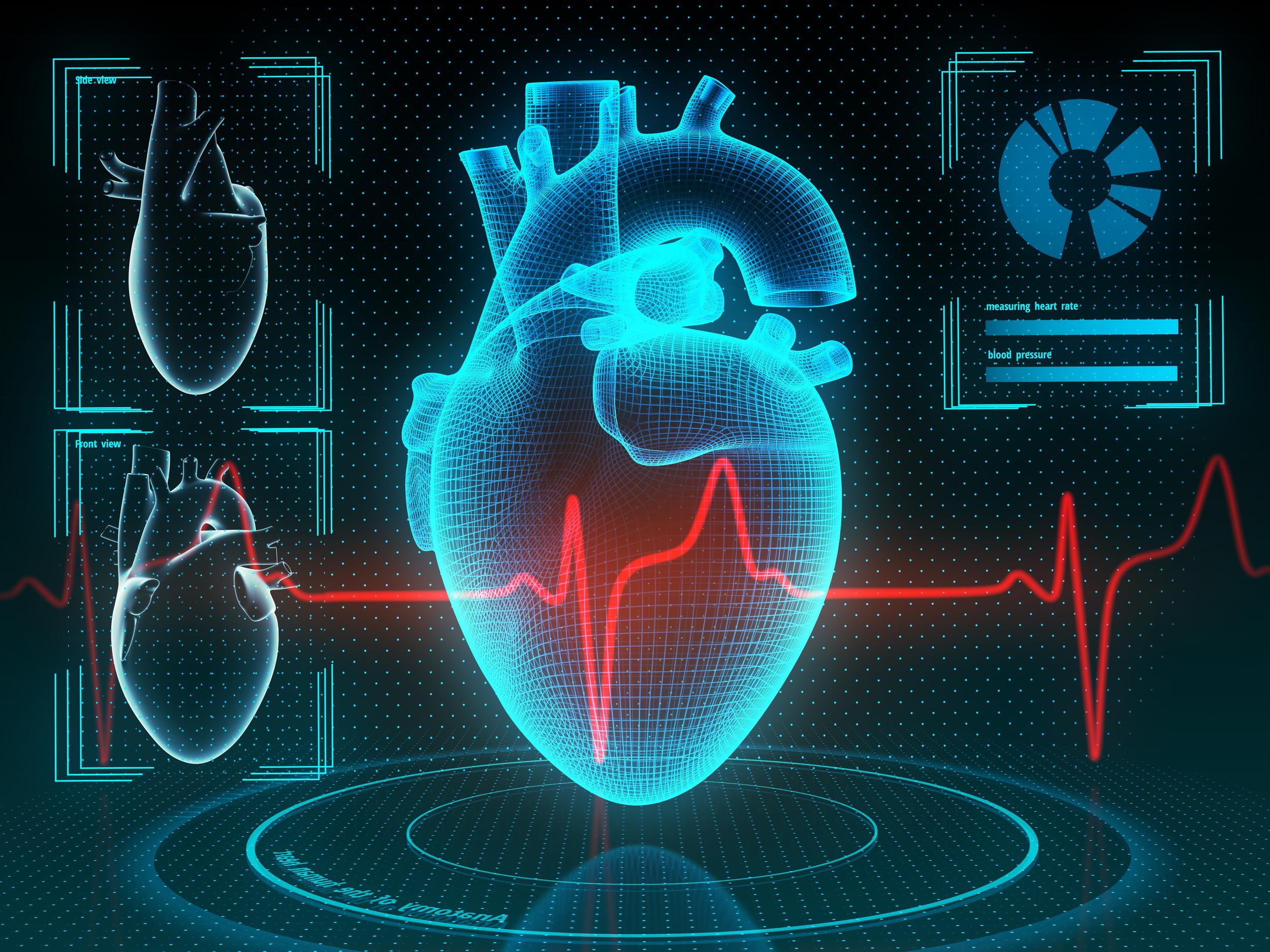 Artificial Intelligence In Cardiology 